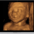 3D Ultrasound