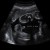 gender-ultrasound-boy-300x188